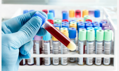 Burundi, misteriosa malattia: 5 morti e 35 contagi nel distretto di Mpanda